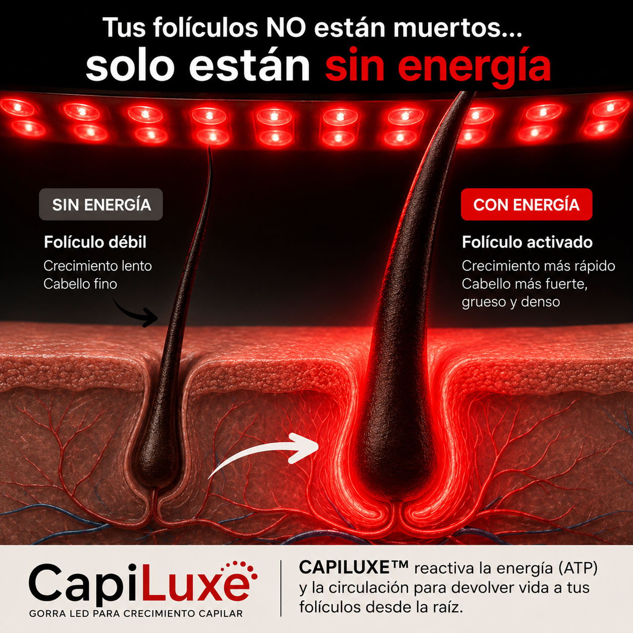 Gorra de Regeneración Capilar